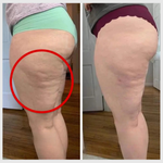 Charger l'image dans la galerie, Photo avant après illustrant la réduction de la cellulite sur les cuisses après utilisation du legging 3D sculptant Zafora