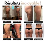 Charger l'image dans la galerie, Résultats avant après du legging sculptant 3D Zafora montrant une forte réduction de la cellulite
